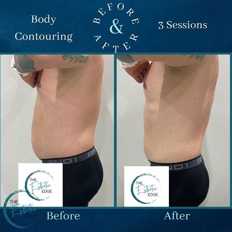 body contouring surgery near me.